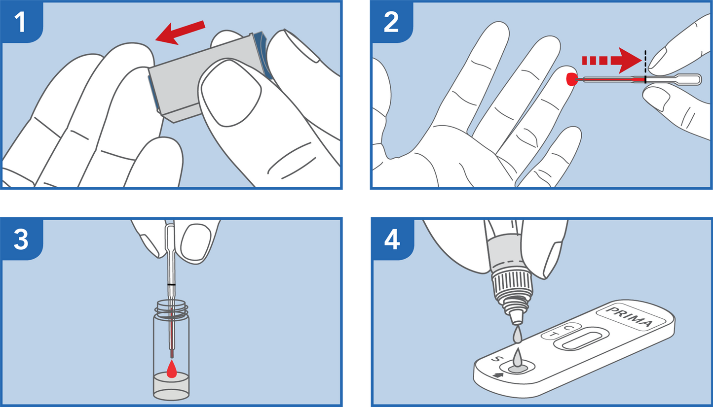 Prima HIV 1&2 Self Test